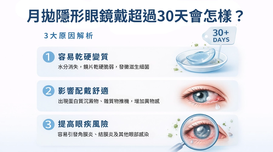 月拋隱形眼鏡戴超過30天會怎樣？3大原因解析