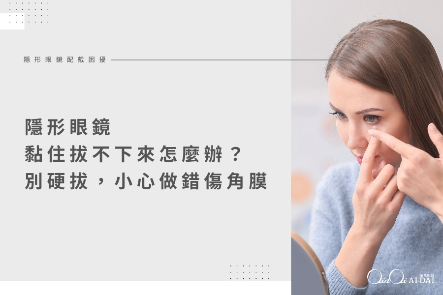 隱形眼鏡黏住拔不下來怎麼辦？別硬拔，小心做錯傷角膜